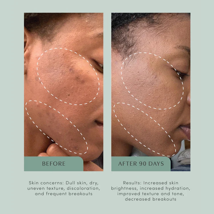 The Honest Youth Skin Support Tincture